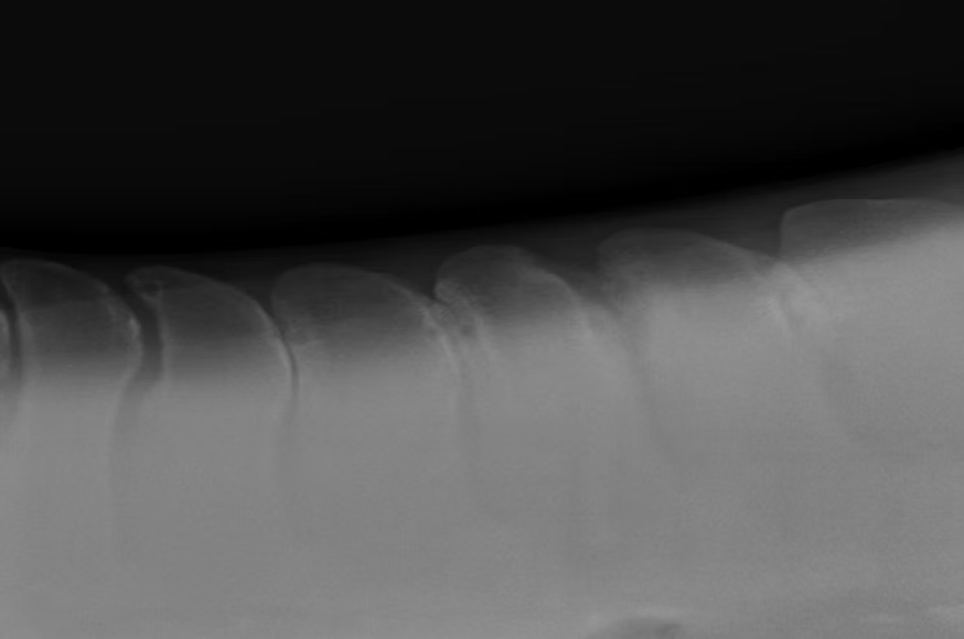 Lateral equine thoracic spine radiograph used during veterinary evaluation for kissing spine